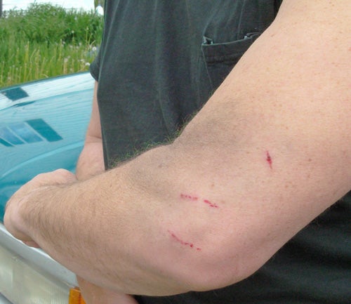 Bite Marks From Coyote Attack